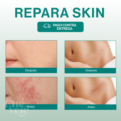 Repara Skin®